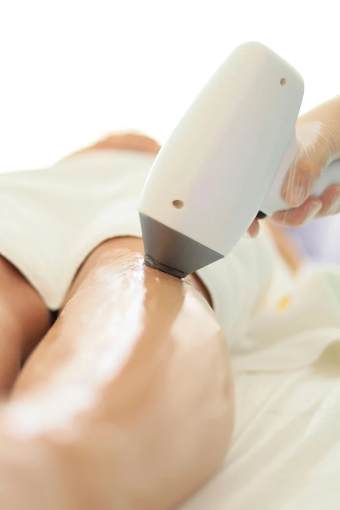 depilacion laser zonas intimas sevilla