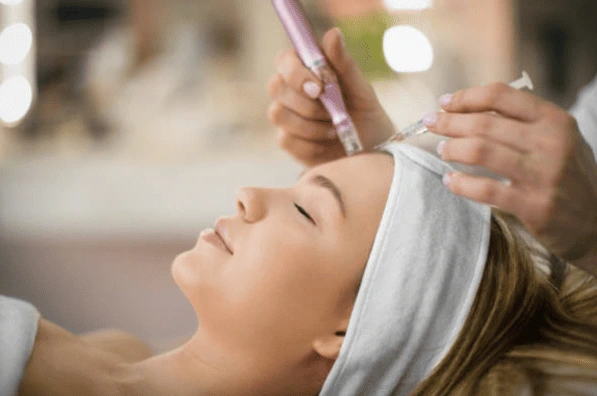 tratamiento facial microneedling sevilla