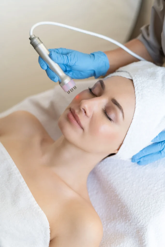 radiofrecuencia facial sevilla